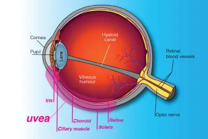 Total Retina & Uvea
