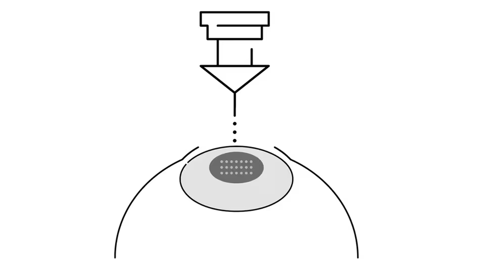 Laser precision illustration