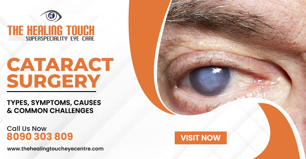 Cataract Surgery: Types, Symptoms, Causes & Common Challenges