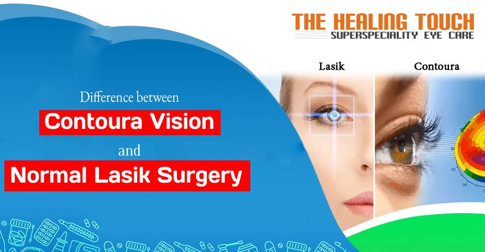 Difference between Contoura Vision and Normal Lasik Surgery