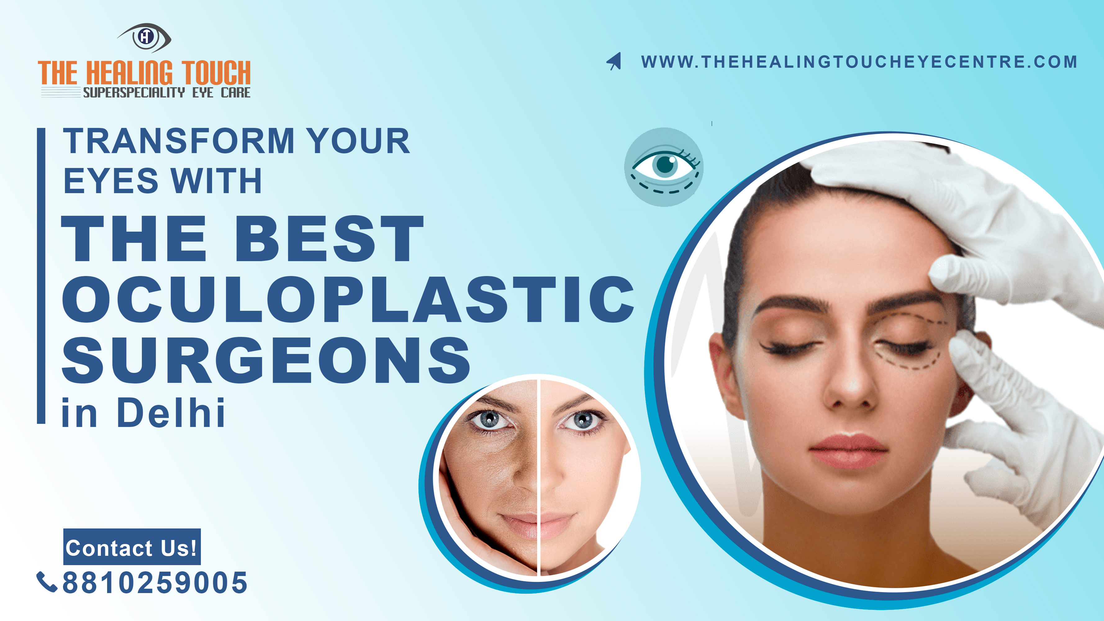 Transform Your Eyes with the Best Oculoplastic Surgeons in Delhi